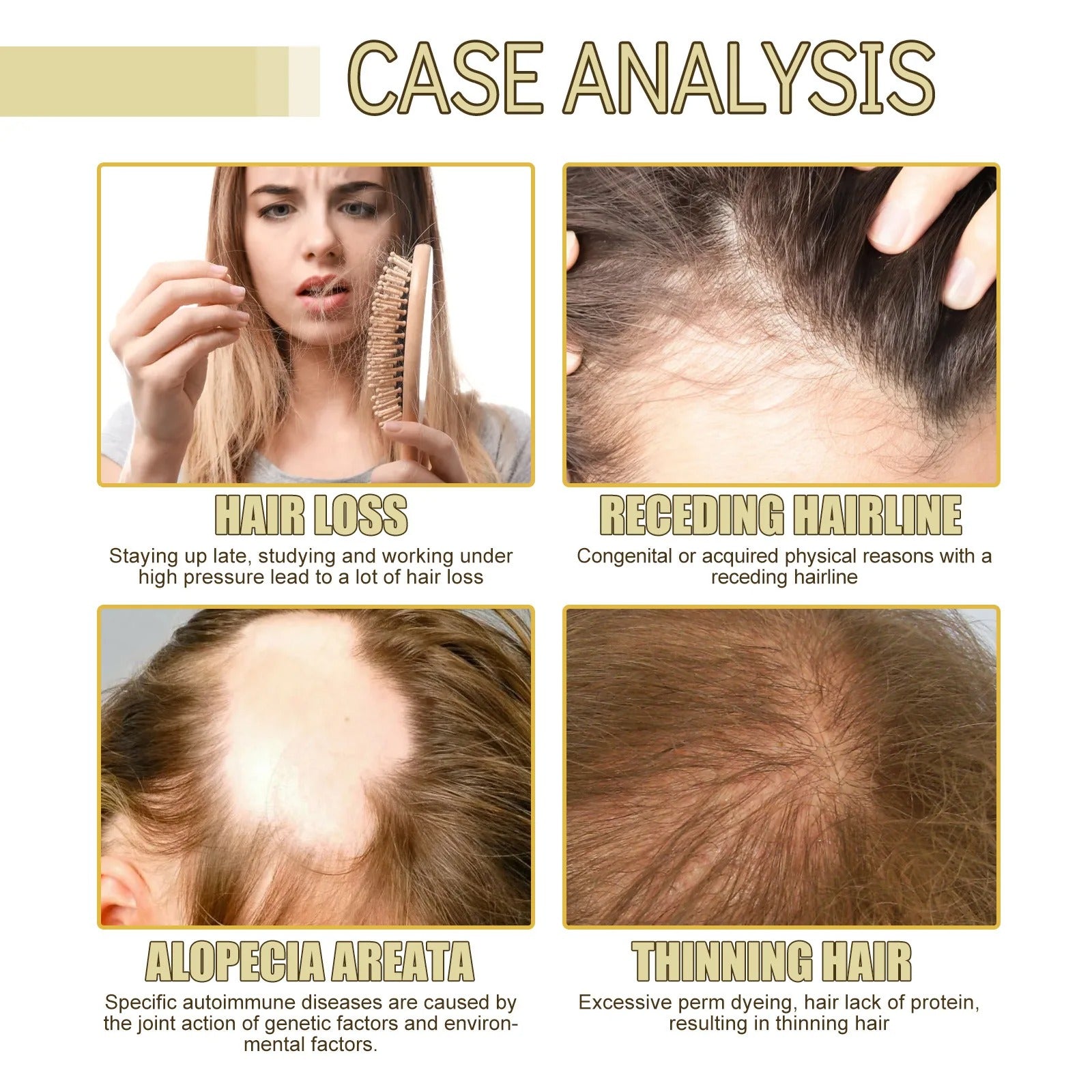 Eelhoe Rosemary Hair Oil – Hair Growth & Scalp Nourishing Serum